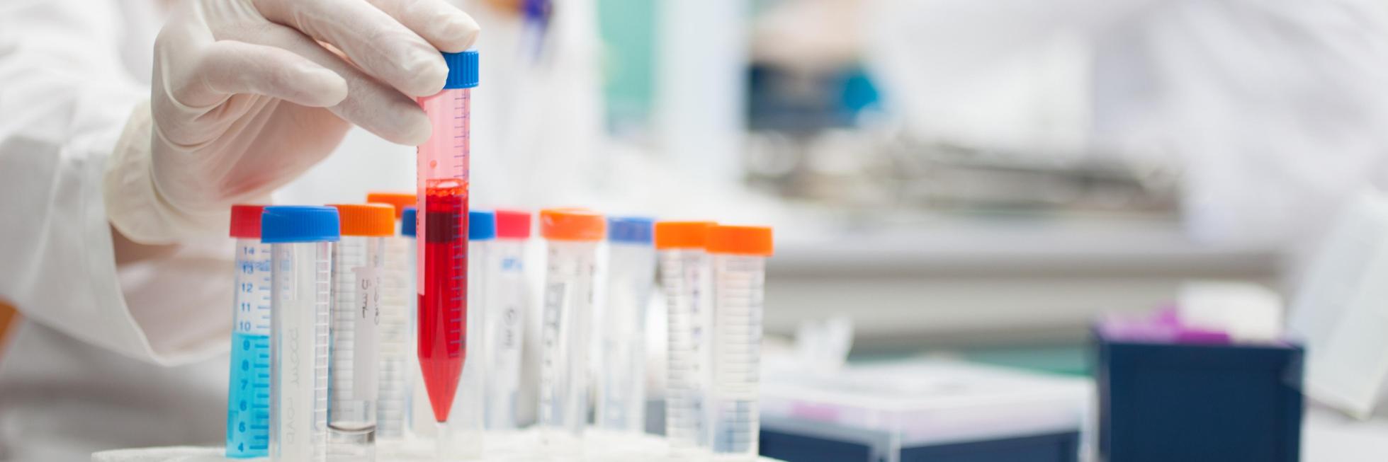 clinical trials